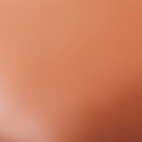 Chestnut Orange
